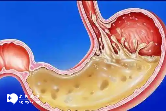 孕妇胃酸该怎么缓解，饭后一杯水是关键，让你告别胃部不适感！
